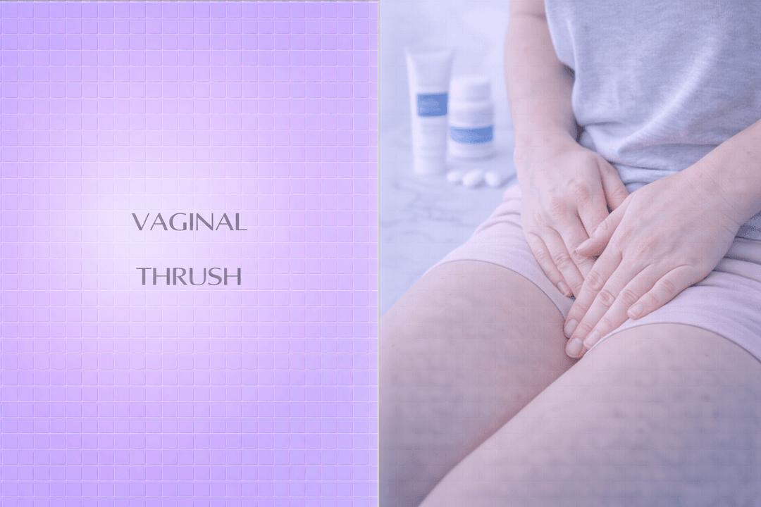 Vaginal Thrush