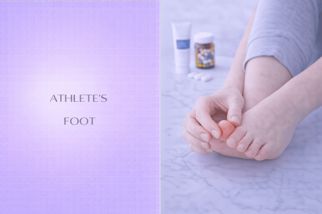 Athlete Foot