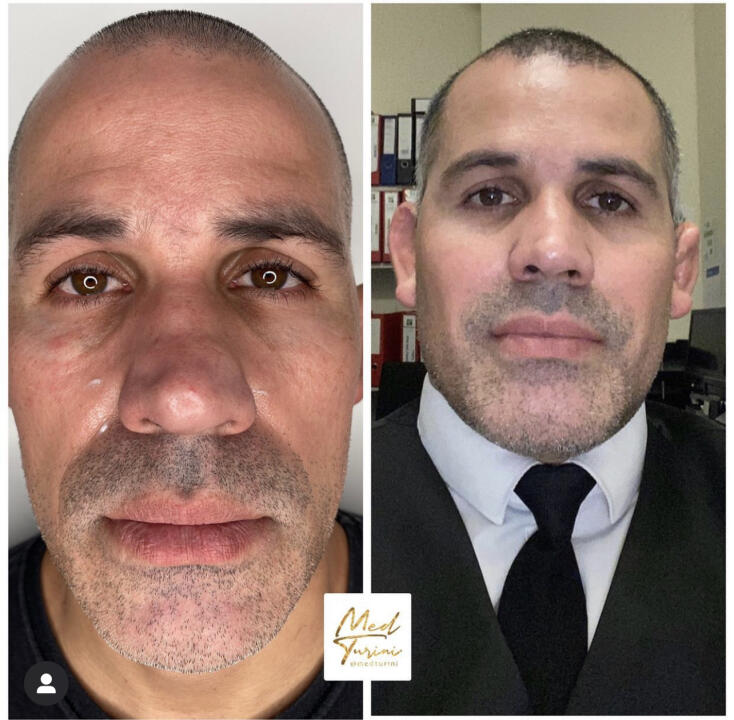 Medturiniaesthetic