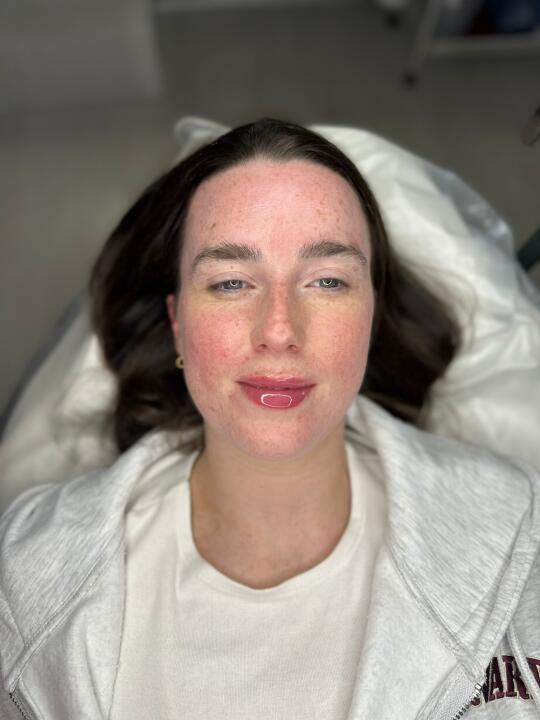 Face Aesthetics