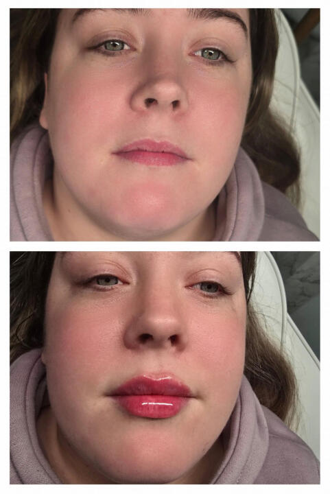 Chloes beauty and aesthetics