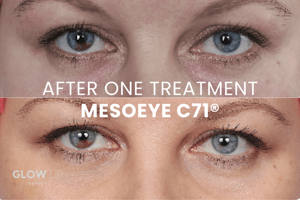 MESOEYE C71® - ABG LAB - UNDEREYE BAG REJUVENATION - 1