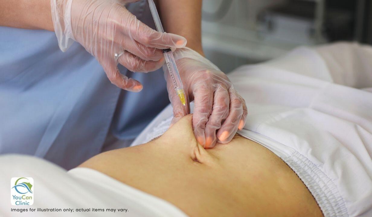 INTRALIPONEEDLE  20G X 100MM X 20 (CANNULA) - 2