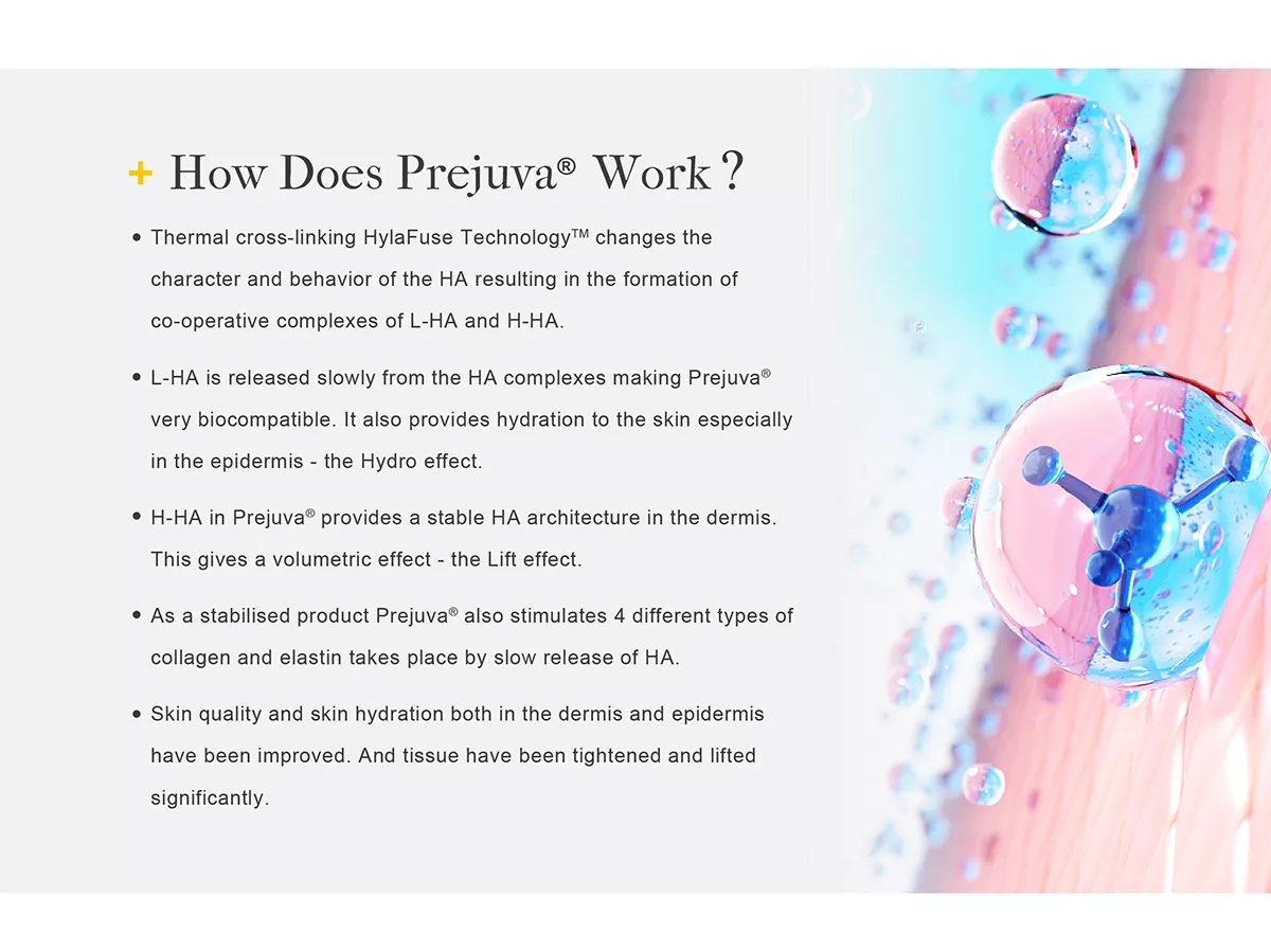 Prejuva H+L 2ML Hyaluronic acid (HA) sodium salt - 1