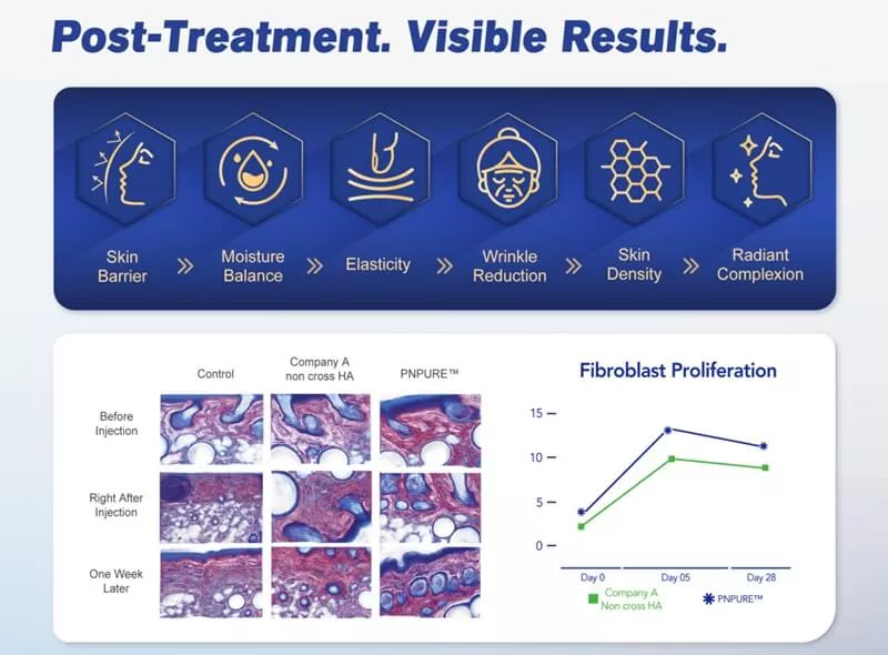 PNPURE™ Advanced Polynucleotides Filler - 5