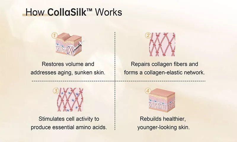 CollaSilk™ Type 1 Bovine Collagen Filler - 5