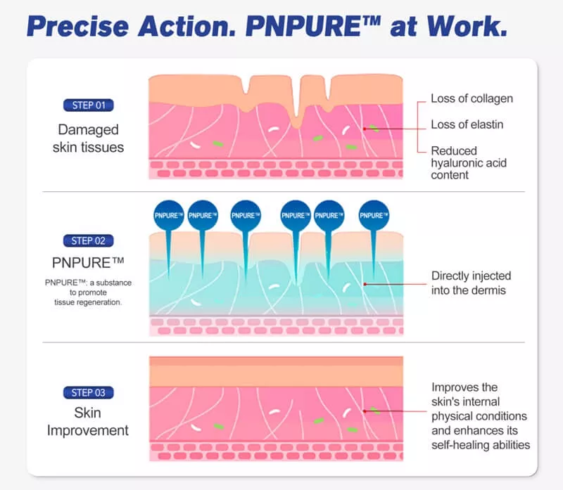 PNPURE™ NeoEye Polynucleotides for Under Eye - 4