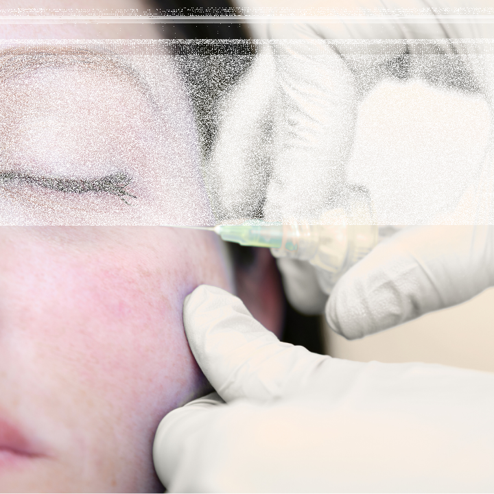 Carboxytherapy Training