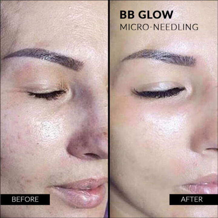 Stayve Dermawhite Ampoule No.1 Light (8ml x12) - 4