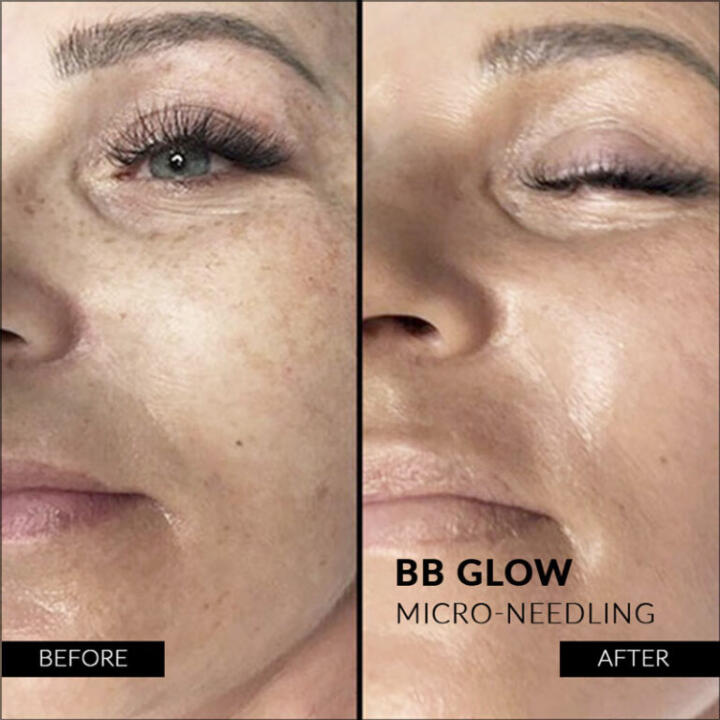 Stayve Dermawhite Ampoule No.1 Light (8ml x12) - 3