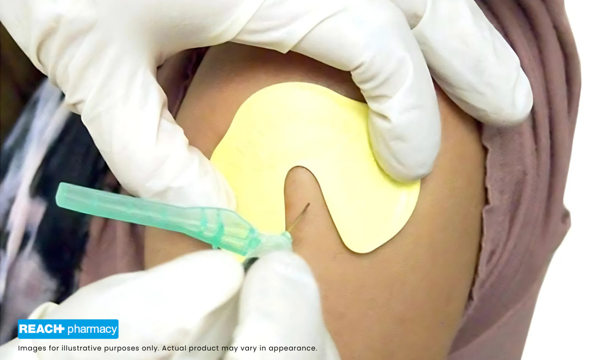 Bionix ShotBlocker Injection Pain Reducer - 2